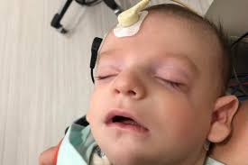 Fundraiser for Christiane Knighten by Hunter Knighten : The Extraordinary  Hunt- Treacher Collins Syndrome