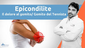 Epicondilite Cosa E Il Dolore Al Gomito Chiamato Anche Gomito Del Tennista Youtube