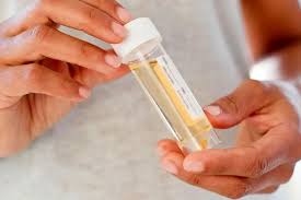 Image result for Clean Catch Urine Collection
