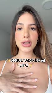 LOS RESULTADOS AL FINNNN!! Como me dejaron en @nikkisplasticsurgery 🥹🤍  que les parece?😭, ., #parati #lupa #viral #lipo