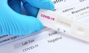 A negative pcr test with a medical certificate is then required to enter the country. Test Pcr Covid 19 In 72 Hours Consulat General De France A Miami