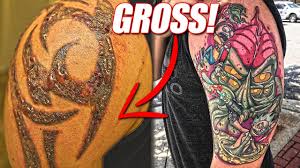 A student has been left with horrific scarring after a tattoo removal went horribly wrong. Tattoo Removal Goes Wrong Finished Tattoo Youtube