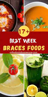 Foods To Eat With Braces The First Week With List Braces Food Braces Food