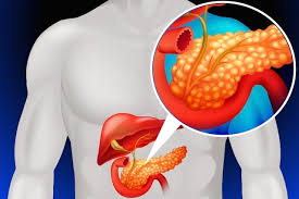 O paciente recebe soro intravenoso, antibióticos e medicamentos. Pancreatite O Que E Sintomas E Principais Causas Tua Saude