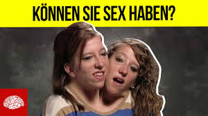 Die letzten 10 beiträge im forum eltern mit zwillingen, drillingen und mehr. Fakten Uber Siamesische Zwillinge Youtube