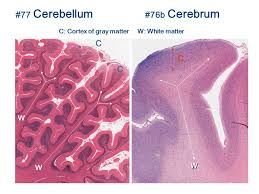 Somewhat than having a direct connection, the cerebellum communicates with the cerebrum by way of the mind stem. Central Nervous System Histology Slide Orientation Ppt Download