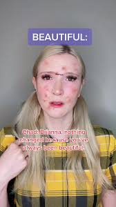 Beauty or Popularity Dilemma: Brianna’s Choice