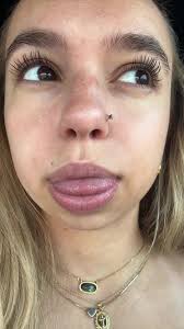 Do you have a piercing bump? This stuff actually works! #piercing #pie...