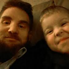 Mitchell Hunter with full face transplant says he feels like 'another face  in the crowd'