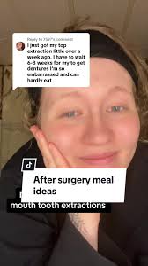 Replying to @7597 Meal ideas for after having full mouth tooth extractions  with or without immediate dentures! These are some of the foods that I  survived