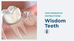 Post Operative Instructions Wisdom Teeth In Lubbock Tx