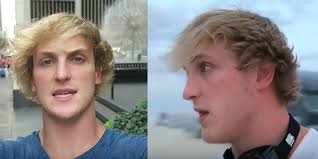 Have you ever wrapped your hair around your wand too tightly or held it against the barrel too long and make your bun stay up on its own with a sliver of your own hair. Logan Paul Hair Loss And Balding Top Hair Loss Treatments