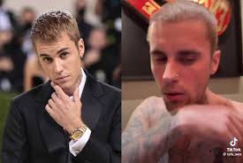 Justin Bieber Sparks Concern With Fans After Hopping On Live • Hollywood  Unlocked