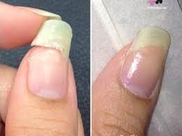 Cela fait deux fois que je fais des poses au gel sur des modèles une en gainage et l'autre avec prothèse et au bout de une semaine et demi tout dépend, les filles me disent que le gel s'est cassé, fendu au milieu de l'ongle et malheureusement défois l'ongle naturel se. Epingle Sur Astuces En Tout Genre