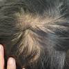 Dengan memiliki rambut yang tebal anda bisa mengereasikan model dan gaya rambut. 1