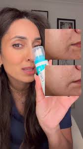 Transform Your Skin with Cerave Resurfacing Retinol Serum