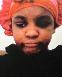 SARATOGA SPRINGS, NY-MISSING PERSONS COLD CASE‼️ Tammie Anne McCormick was  just 13 years old, when she went missing in Saratoga Springs, NY,