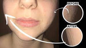 The claim finishing touch lumina hair remover claims that it. Finishing Touch Flawless Review Is This Facial Hair Remover Worth It Reviewed