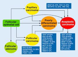 Papillary thyroid cancer (also sometimes called papillary thyroid carcinoma) is the most common type of thyroid cancer. Poorly Differentiated Thyroid Carcinoma Springerlink
