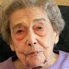 Madeline, 106 anni: «Se sono ancora viva è perché sono rimasta single»