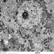 Taking up most of the cell is the nucleus, where genes are stored in the form of chromosomes. Electron Micrograph Of Control Rat Liver Group I Showing Fig 4a A Download Scientific Diagram