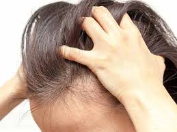 Of 403 examined patients, 20% of women and 9% of men reported hair pain, irrespective of the cause and activity of hair loss. What Are The Signs Of New Hair Growth Lewigs