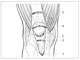 Image result for Ballottable Patella Sign