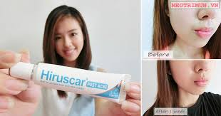 Hiruscar post acne smells of herbs, i personally feel close to the smell of ginger, transparent gel, applied to the skin feels very cool, absorbent fast and dry after only a few seconds. Hiruscar Post Acne Review Máº¹o Trá»‹ Má»¥n
