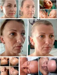 Recommending Kobido Facial Massage With Lynne Moreno! So relaxing and  stress relieving