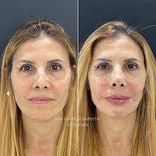 Dra Danielle Barreto