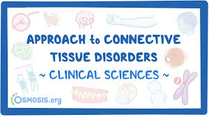 Image result for Connective Tissue Disorder