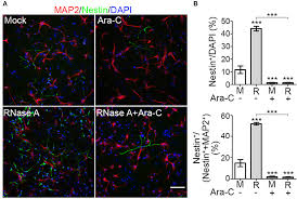 We did not find results for: Frontiers Rnase A Promotes Proliferation Of Neuronal Progenitor Cells Via An Erk Dependent Pathway Molecular Neuroscience