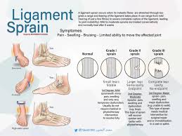 May 22, 2021 · dunedin, fla. Muhammad Alhudaib On Twitter Quick Study Ligament Sprain Anatomy Injury Physical Therapy Pt Physiotherapy Ligament Sprain Ø§Ù„Ø¹Ù„Ø§Ø¬ Ø§Ù„Ø·Ø¨ÙŠØ¹ÙŠ Ø¹Ù„Ø§Ø¬ Ø·Ø¨ÙŠØ¹ÙŠ Quick Study Medical Https T Co Jfjhfmhqei