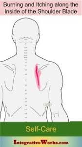 Self Care Burning And Itching Along The Shoulder Blade Integrative Works Shoulder Blades Shoulder Blade Stretch Yoga Shoulder