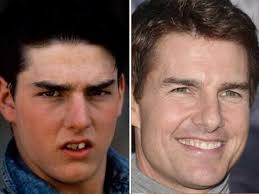 Tumbalatum, elas gosta, ta bombando é & tuturutum produção musical. Compare Os Dentes Dos Famosos Antes E Depois Da Fama Fotos R7 Hoje Em Dia