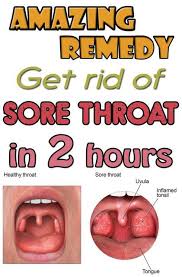 Home Remedies For Sore Throat Throat Remedies Strep Throat Remedies Sore Throat Remedies