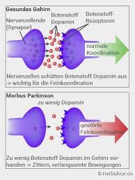 The american parkinson disease association details the early warning signs. Parkinson Krankheit Fruhwarnzeichen Symptome Therapie Netdoktor