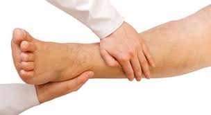 Venenentzundung Phlebitis Thrombophlebitis
