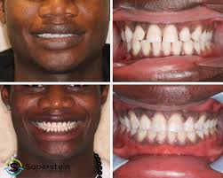 Saperstein Orthodontics