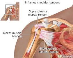 The clavicle (collarbone), the scapula (shoulder blade), and the humerus (upper arm bone) as well as associated muscles, ligaments and tendons. Rotator Cuff Problems Medlineplus Medical Encyclopedia