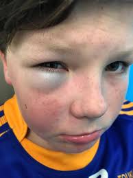 A huge shout out to all our boys for pulling together today in a rough and  muddy game against Treorchy 🏉 𝗙𝗼𝗿𝘄𝗮𝗿𝗱 𝗼𝗳 𝘁𝗵𝗲 𝗺𝗮𝘁𝗰𝗵