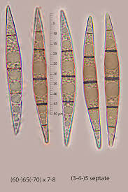 Image result for Trochomeria subglabra