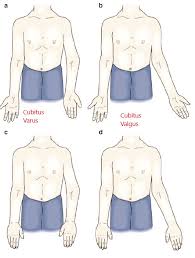 Image result for Elbow Exam