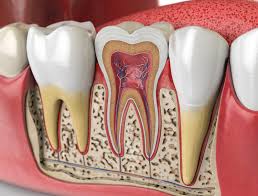 Symptome zeigen, wann eine wurzelbehandlung notwendig ist. Wurzelbehandlung Ludwigsburg Zahnarzt Dr Hauk