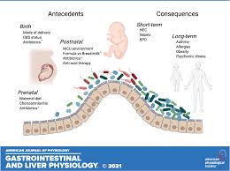 We report here a preterm patient who died because of severe diffuse necrotizing enterocolitis (nec) after topical application of 0.5% cyclopentolate and 1.25% phenylephrine during rop screening to emphasise the serious side effects of these agents. Dynamics Of The Preterm Gut Microbiome In Health And Disease American Journal Of Physiology Gastrointestinal And Liver Physiology