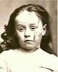 The Founding of the New York Society for the Prevention of Cruelty to  Children