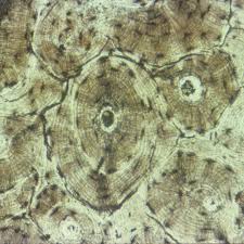 Free online quiz compact bone microscope slide labeled. Cartilage And Bone Microscope Slides Carolina Com