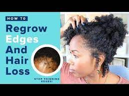 Get Perfect Clear Skin In 1 Week Naturally 18 Diy Hacks That Really Work Contest Youtube Regrow Edges Natural Hair Styles Regrow Hair Naturally