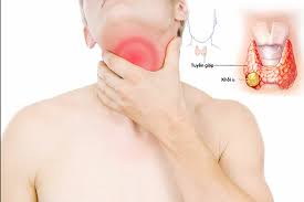Triệu chứng bệnh ung thư tuyến giáp sớm. Ung ThÆ° Tuyáº¿n Giap áº£nh HÆ°á»Ÿng Tháº¿ Nao Ä'áº¿n Sá»©c Khá»e