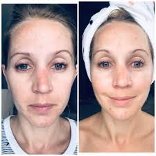 Lazy skincare routine results in glowing skin